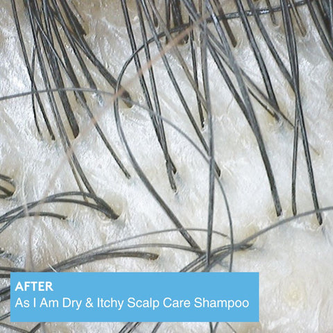 Image of Dry & Itchy Scalp Care Shampoo Position 6