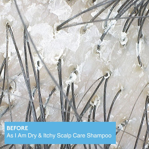 Image of Dry & Itchy Scalp Care Shampoo Position 5