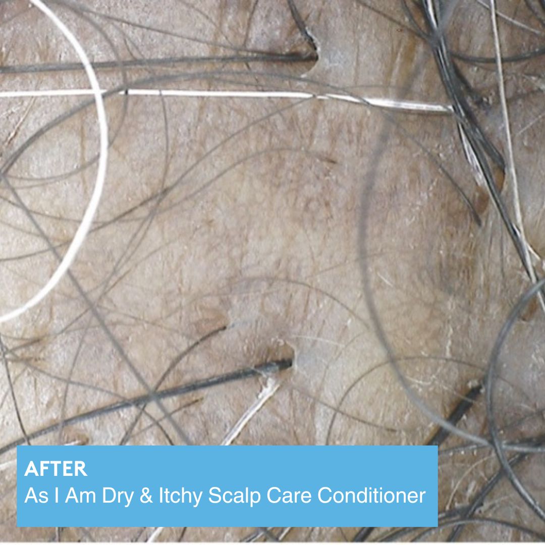 Dry & Itchy Scalp Care Conditioner Position 6