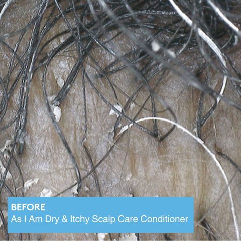 Image of Dry & Itchy Scalp Care Conditioner Position 5